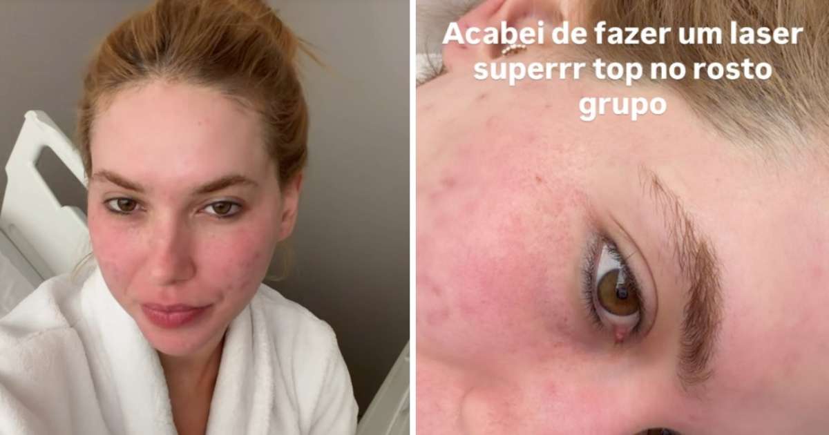 virginia-desmente-boatos-de-cirurgia-no-rosto-e-afirma:-‘foi-so-laser-mesmo’