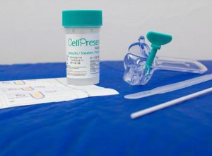 saiba-como-e-o-novo-teste-do-sus-para-detectar-cancer-de-colo-do-utero