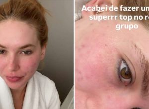 virginia-desmente-boatos-de-cirurgia-no-rosto-e-afirma:-‘foi-so-laser-mesmo’