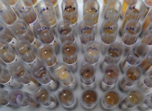 casos-de-malaria-no-brasil-caem-26%-no-primeiro-trimestre-de-2025